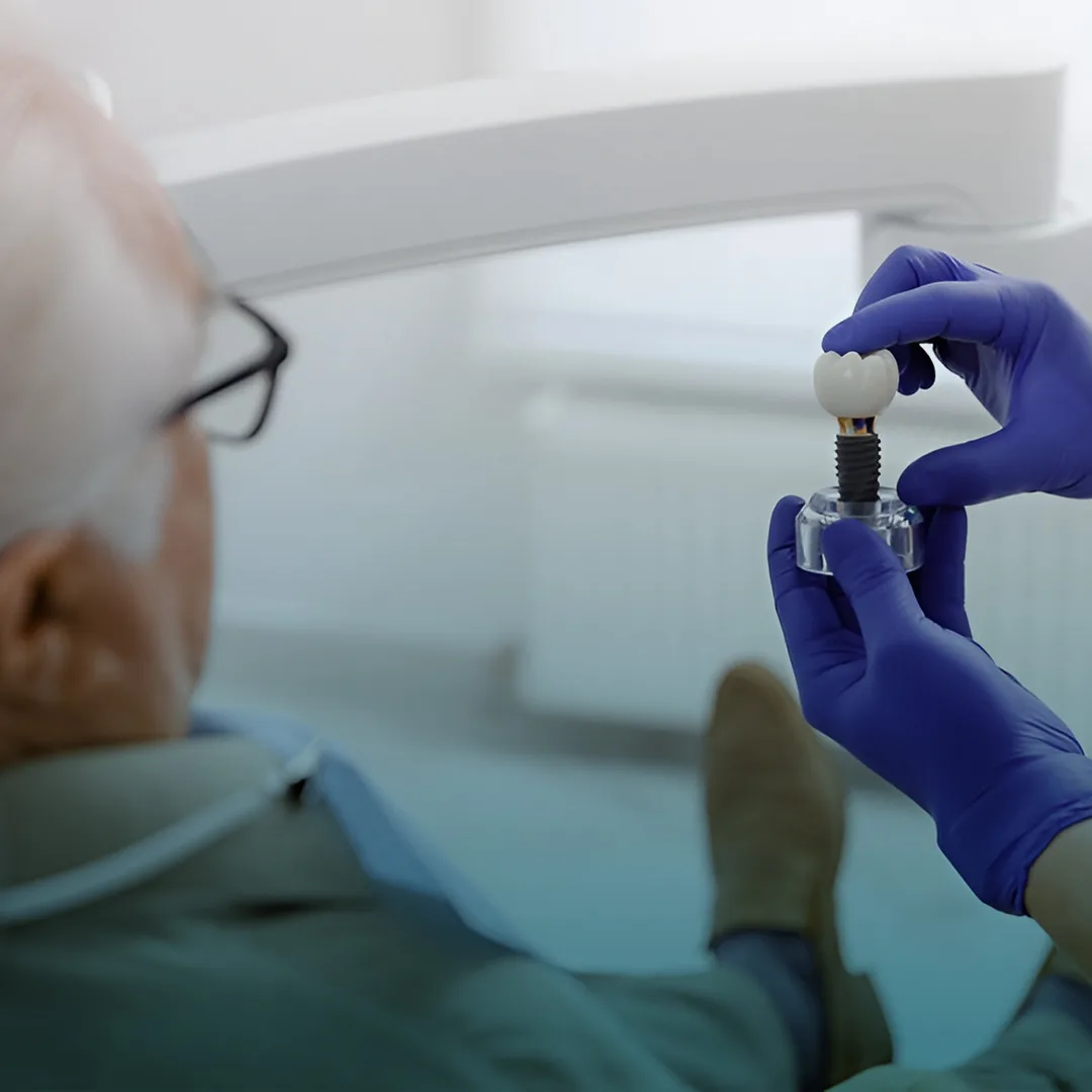 Dental implants and replacement teeth
